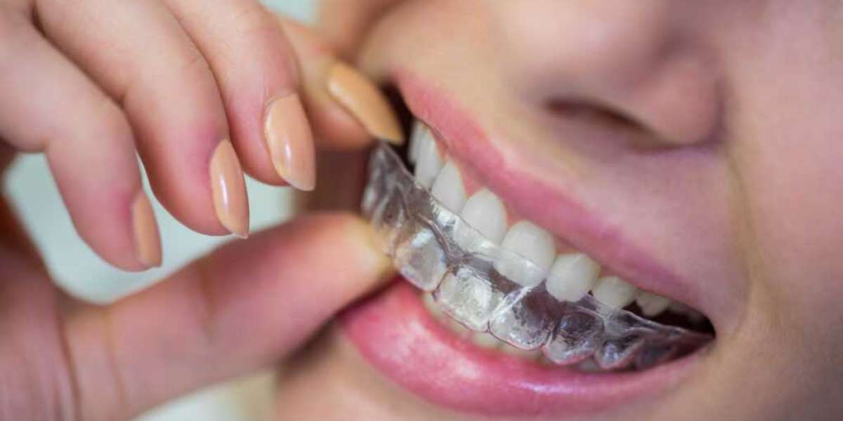 teeth invisalign cost