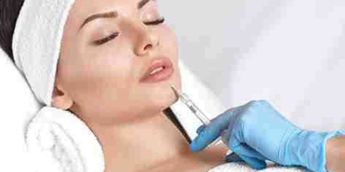 Enhancing Confidence Through Artful Lip Filler Techniques
